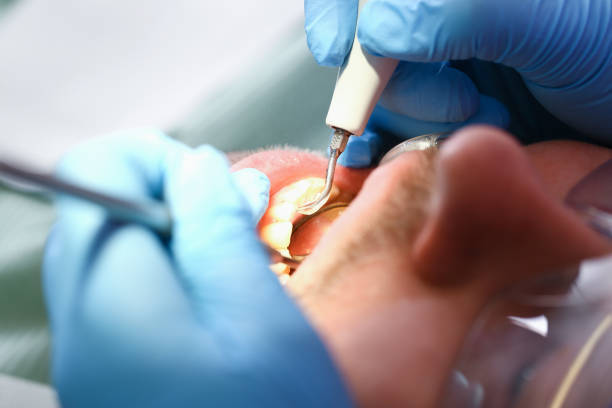 Best Urgent Tooth Repair  in North Beach, MD