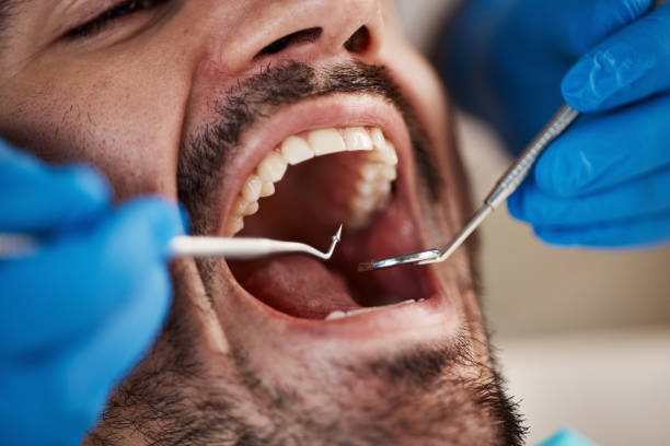 Best Knocked-Out Tooth Emergency  in North Beach, MD